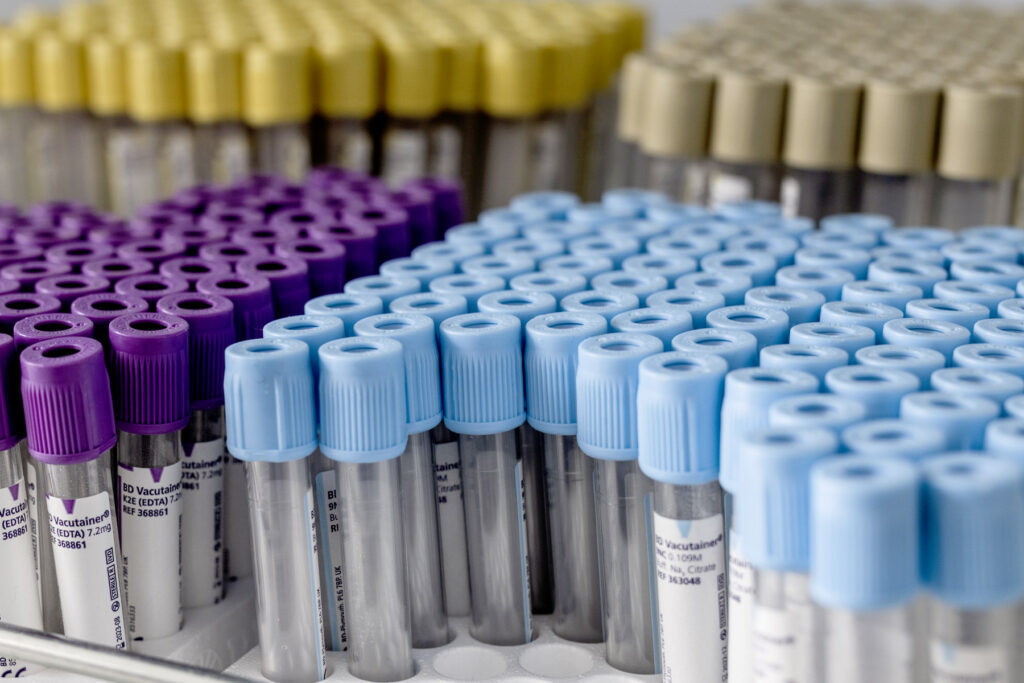 Poliambulatorio Sanimilia - Provette Analisi